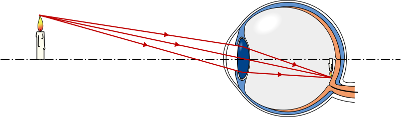 Figure 3 - Rayons convergents